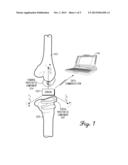 Edge-Detect Receiver For Orthopedic Parameter Sensing diagram and image