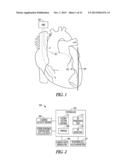 PHRENIC NERVE STIMULATION DETECTION diagram and image