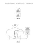 PHRENIC NERVE STIMULATION DETECTION diagram and image