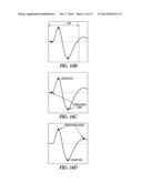 PHRENIC NERVE STIMULATION DETECTION diagram and image