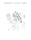 SYSTEM AND METHOD FOR VALIDATING AN ORTHOPAEDIC SURGICAL PLAN diagram and image