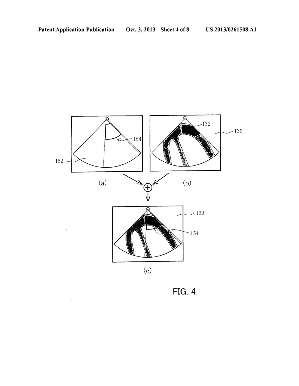 ULTRASOUND TREATMENT DEVICE AND CONTROL METHOD THEREOF - diagram, schematic, and image 05