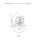 Devices and Methods for Dilating a Paranasal Sinus Opening and for     Treating Sinusitis diagram and image