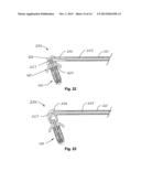 Devices and Methods for Dilating a Paranasal Sinus Opening and for     Treating Sinusitis diagram and image