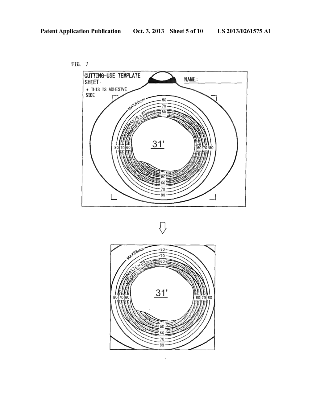 METHOD OF FORMING OPENING IN BASE PLATE OF STOMA DEVICE, TEMPLATE SHEET     AND LABEL USED IN THIS METHOD, AND BASE PLATE AND STOMA DEVICE - diagram, schematic, and image 06