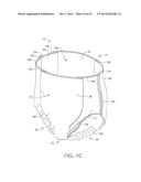 Absorbent Article diagram and image