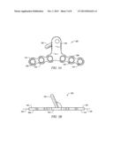 MAXILLARY IMPLANT FOR ADVANCEMENT, EXPANSION AND STABILIZATION OF     REPOSITIONED BONE SECTIONS diagram and image