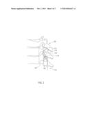 Utilizing Multiple Links to Achieve a Desired Tool Deflection Angle when     Clearing an Epidural Space diagram and image