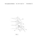 Utilizing Multiple Links to Achieve a Desired Tool Deflection Angle when     Clearing an Epidural Space diagram and image