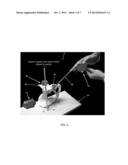 COMPUTER-GUIDED SYSTEM FOR ORIENTING A PROSTHETIC ACETABULAR CUP IN THE     ACETABULUM DURING TOTAL HIP REPLACEMENT SURGERY diagram and image
