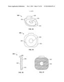 IMPLANT AND ASSOCIATED INSTRUMENTS AND METHODS diagram and image