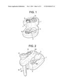 QUAD ANCHOR LATERAL VERTEBRAL BODY FIXATION PLATES diagram and image