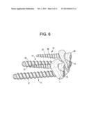 QUAD ANCHOR LATERAL VERTEBRAL BODY FIXATION PLATES diagram and image