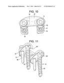 QUAD ANCHOR LATERAL VERTEBRAL BODY FIXATION PLATES diagram and image