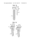 QUAD ANCHOR LATERAL VERTEBRAL BODY FIXATION PLATES diagram and image