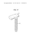 QUAD ANCHOR LATERAL VERTEBRAL BODY FIXATION PLATES diagram and image