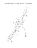 CABLE TETHER SYSTEM diagram and image