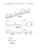 Screwless Retaining Bar diagram and image