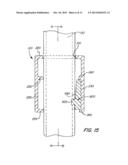 Screwless Retaining Bar diagram and image