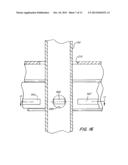 Screwless Retaining Bar diagram and image