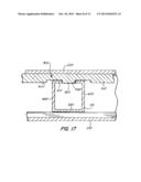 Screwless Retaining Bar diagram and image