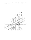 Screwless Retaining Bar diagram and image