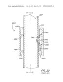 Screwless Retaining Bar diagram and image