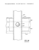 Screwless Retaining Bar diagram and image