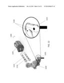 Reducing the Tangling of Cables diagram and image