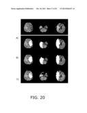 METHOD FOR DELINEATION OF TISSUE LESIONS diagram and image