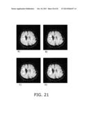 METHOD FOR DELINEATION OF TISSUE LESIONS diagram and image