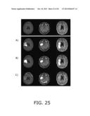 METHOD FOR DELINEATION OF TISSUE LESIONS diagram and image