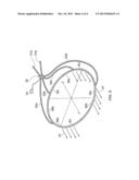 ACTIVE FLOW CONTROL INTAKE FOR A GAS TURBINE ENGINE diagram and image