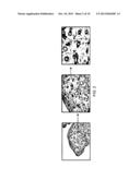 ANTIBODY SPECIFICALLY BINDING SYNOVIAL MICROVASCULATURE OF ARTHRITIS     PATIENTS diagram and image