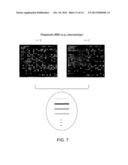 Methods of Detecting Kidney-Associated Diseases or Conditions diagram and image