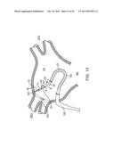 METHODS AND SYSTEMS FOR ABLATING TISSUE diagram and image