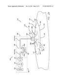 FLEXIBLE REDUCED PRESSURE TREATMENT APPLIANCE diagram and image