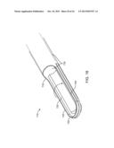 TISSUE EXTRACTION DEVICES AND METHODS diagram and image