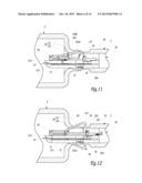 Surgical Treatment System and Method for Performing an Anastomosis Between     Two Hollow Ducts in a Patient, in Particular Between the Bladder and the     Urethra diagram and image