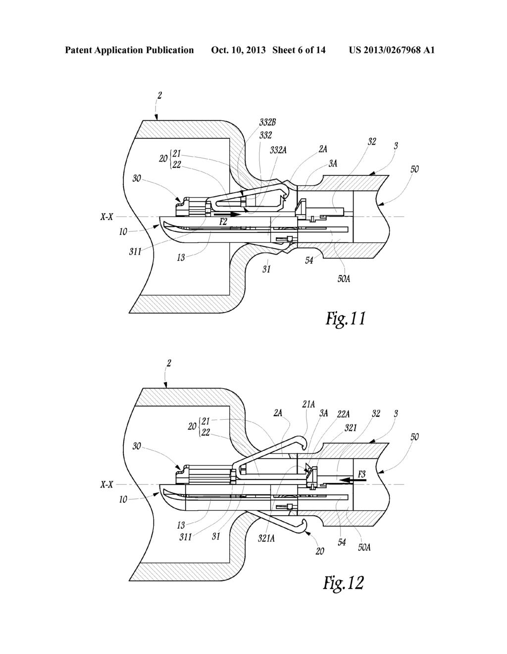 Surgical Treatment System and Method for Performing an Anastomosis Between     Two Hollow Ducts in a Patient, in Particular Between the Bladder and the     Urethra - diagram, schematic, and image 07