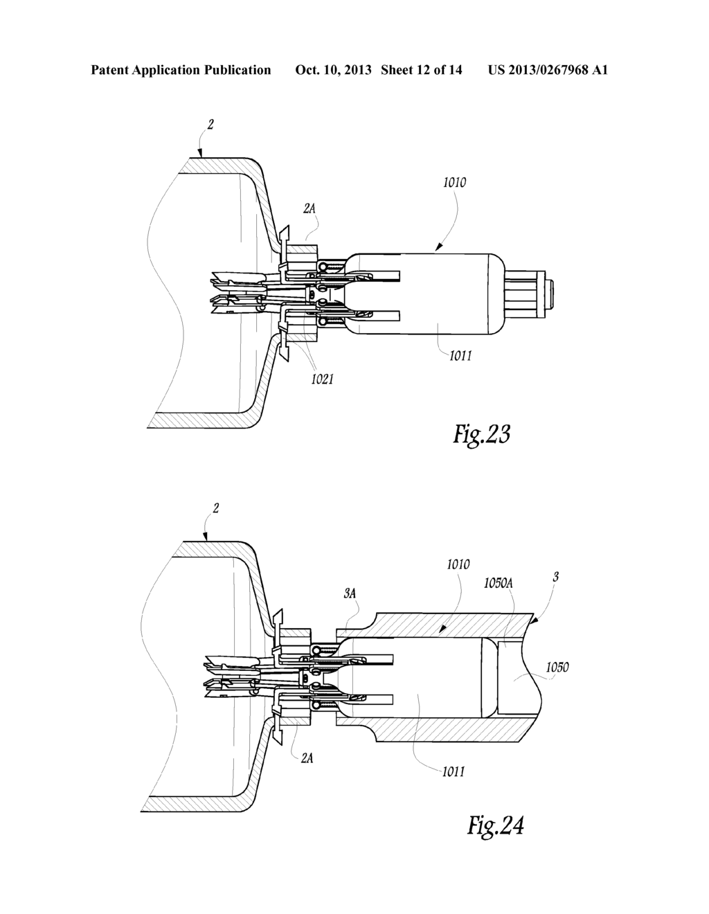 Surgical Treatment System and Method for Performing an Anastomosis Between     Two Hollow Ducts in a Patient, in Particular Between the Bladder and the     Urethra - diagram, schematic, and image 13