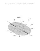 SINGLE PLANE TISSUE REPAIR PATCH diagram and image