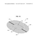 SINGLE PLANE TISSUE REPAIR PATCH diagram and image