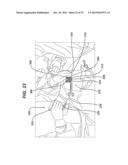 SINGLE PLANE TISSUE REPAIR PATCH diagram and image