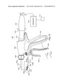 SWITCH ARRANGEMENTS FOR ULTRASONIC SURGICAL INSTRUMENTS diagram and image