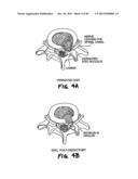 METHOD FOR THE TREATMENT OF TISSUE diagram and image