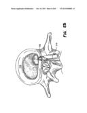 METHOD FOR THE TREATMENT OF TISSUE diagram and image