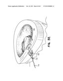 METHOD FOR THE TREATMENT OF TISSUE diagram and image