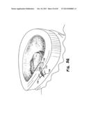 METHOD FOR THE TREATMENT OF TISSUE diagram and image