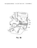 METHOD FOR THE TREATMENT OF TISSUE diagram and image